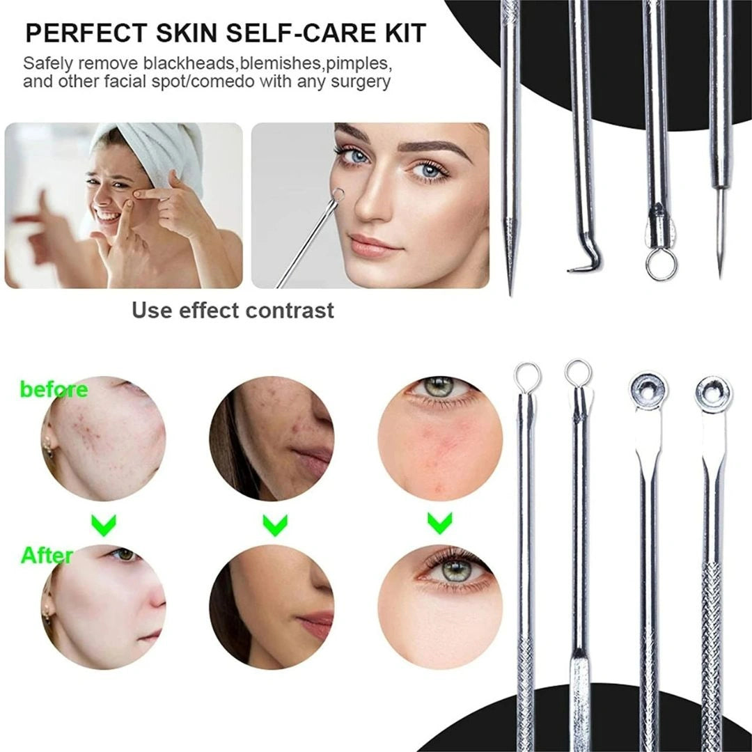 Blackhead Remover & Acne Tool Kit
