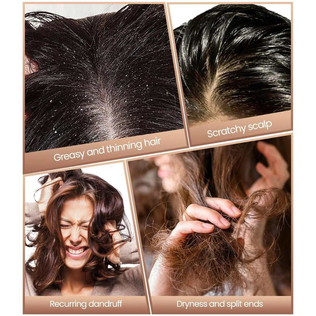 Dandruff Comb