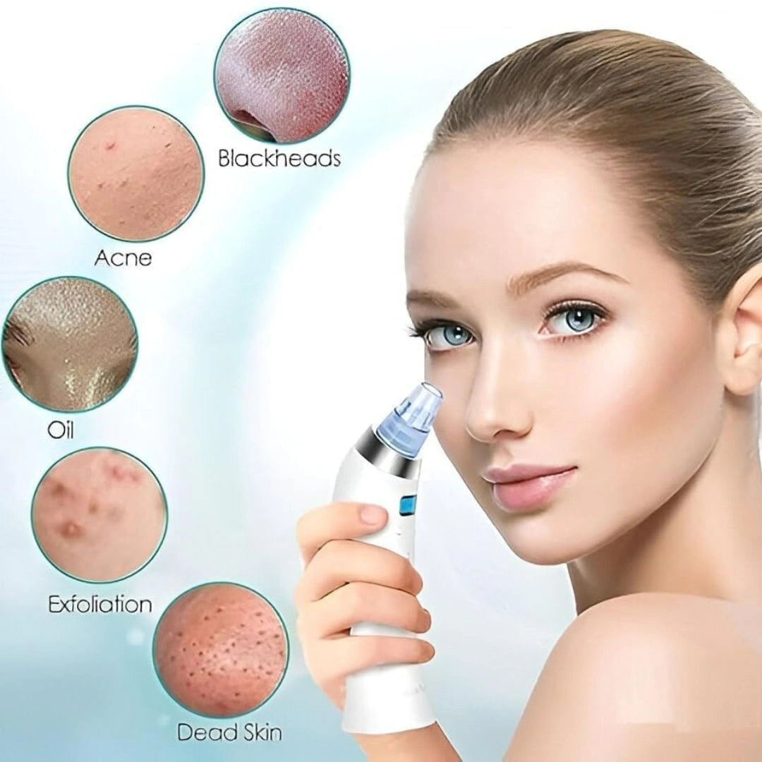 Blackhead Remover Vacuum Device with Suction Heads
