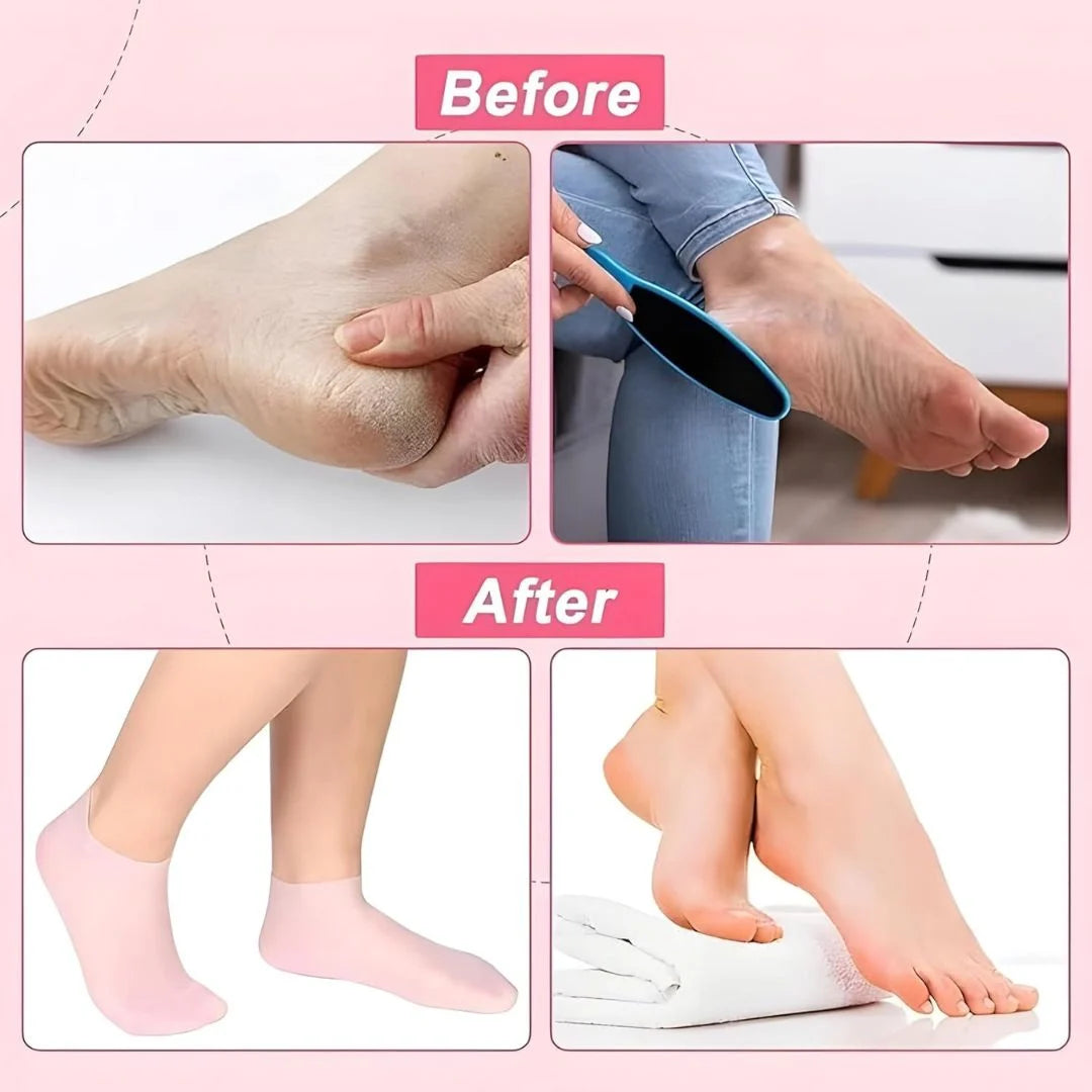 Silicone Gel Socks for Women and Men