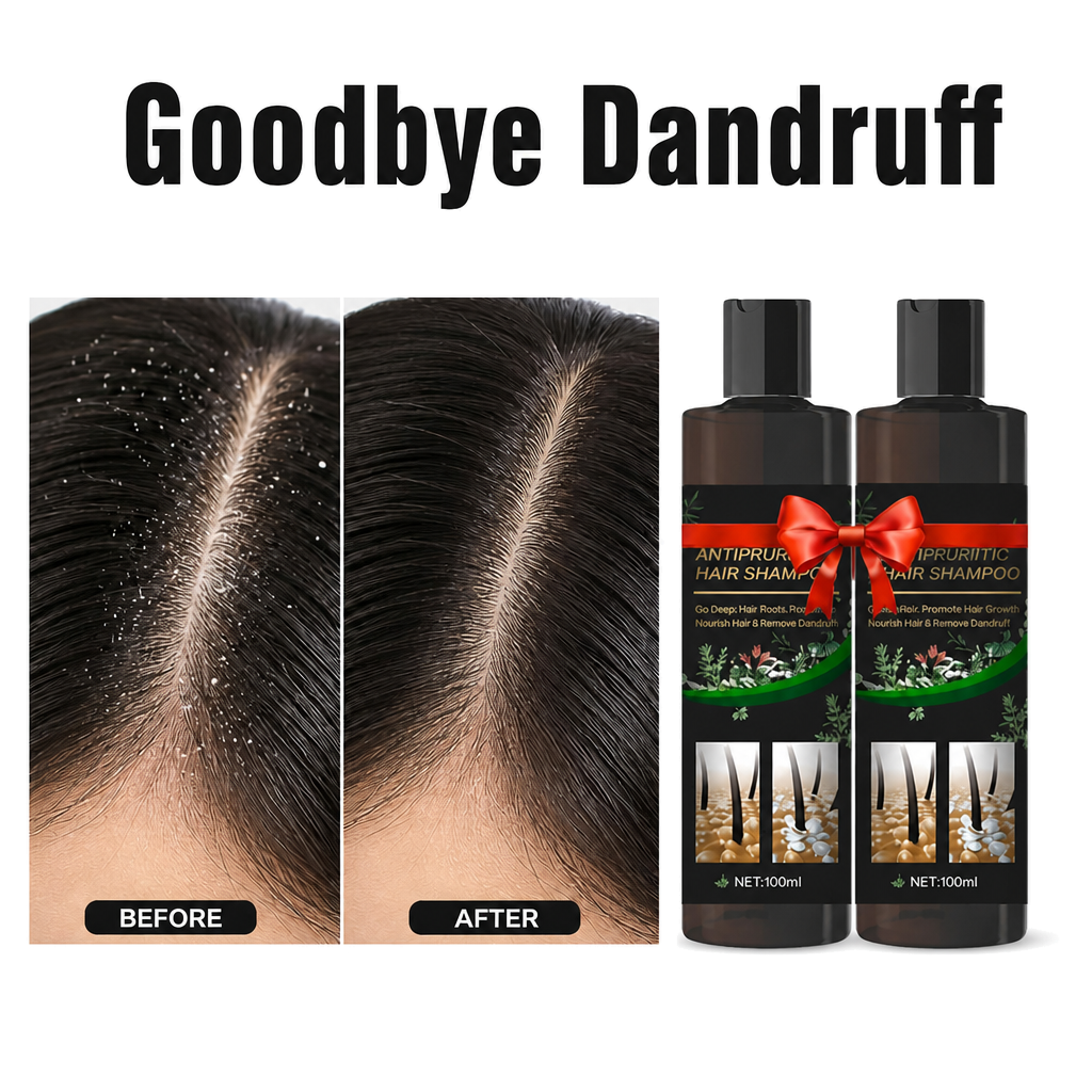 Powerful Anti-Dandruff Shampoo